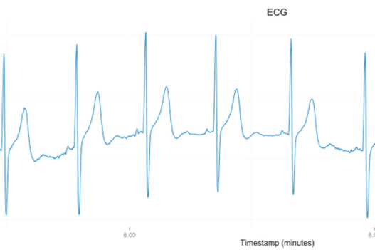 HRV