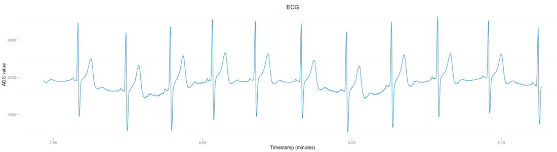 HRV RR interval